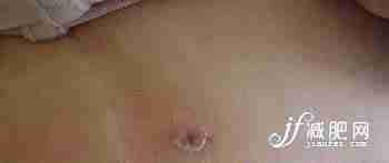 一个mm的抽脂减肥真实全程(图)