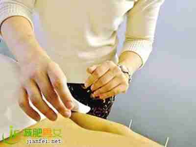 <font color='blue'>中医</font>瘦身 隐形<font color='blue'>针灸</font><font color='blue'>减肥</font>靠谱吗？