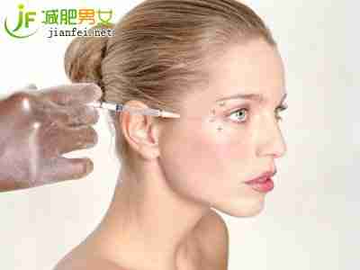 瘦脸术适合人群