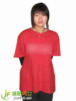 MM减肥后期照片