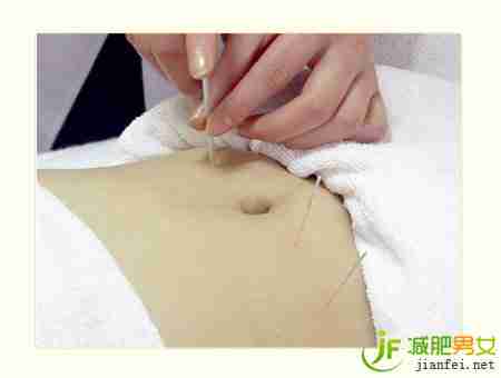 身体体质达标才能进行针灸减肥